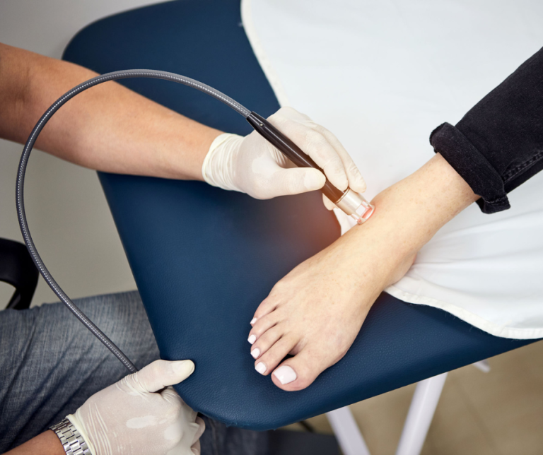 Does Laser Therapy Work for Foot Pain?